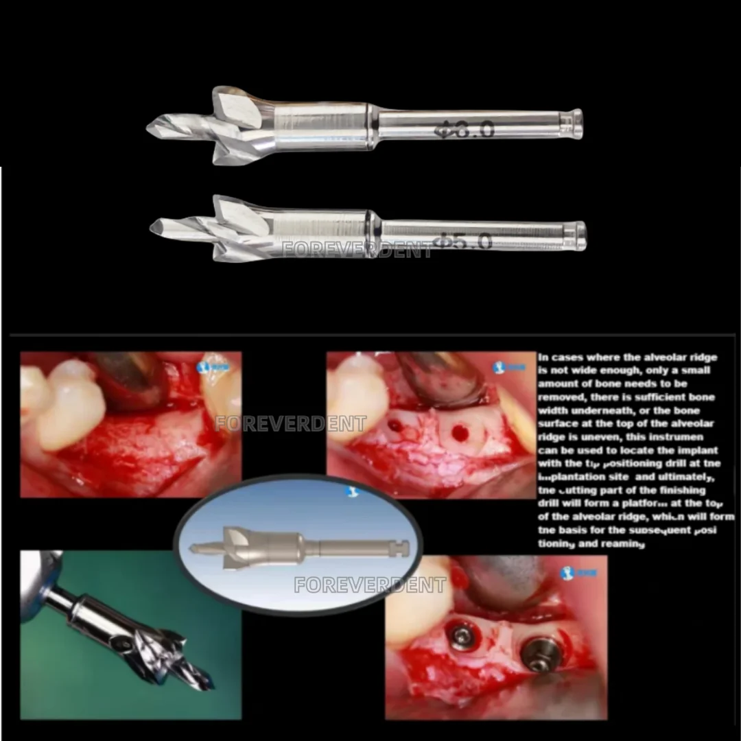

Dental Grinding Bur Universal Implant Bone Profiler With Pilot Drill Implant Debridement Surgical Instrument