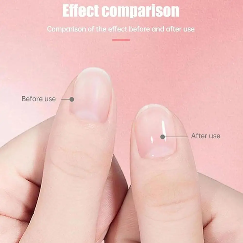 5ml Rejuvenation Nail Growth Oil For Growth And Strength Nail Makeup Cosmetics Cuticle Remover Nail Care Manicure Tools