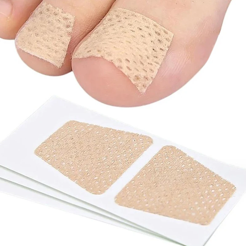 Pegatinas de corrección de uñas encarnadas, parches para el cuidado de los pies, tratamiento de paroniquia, herramienta de pedicura, 2/10 piezas