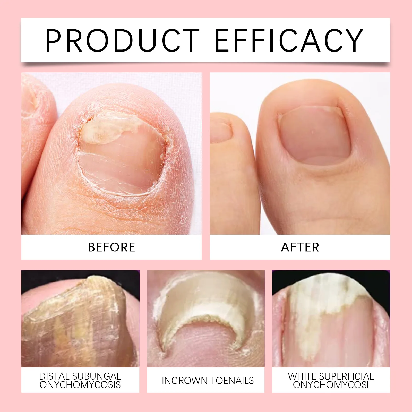 nail polish repair solution repairs damaged nails, nourishes feet, and restores nail shine with nail polish nutrient solution