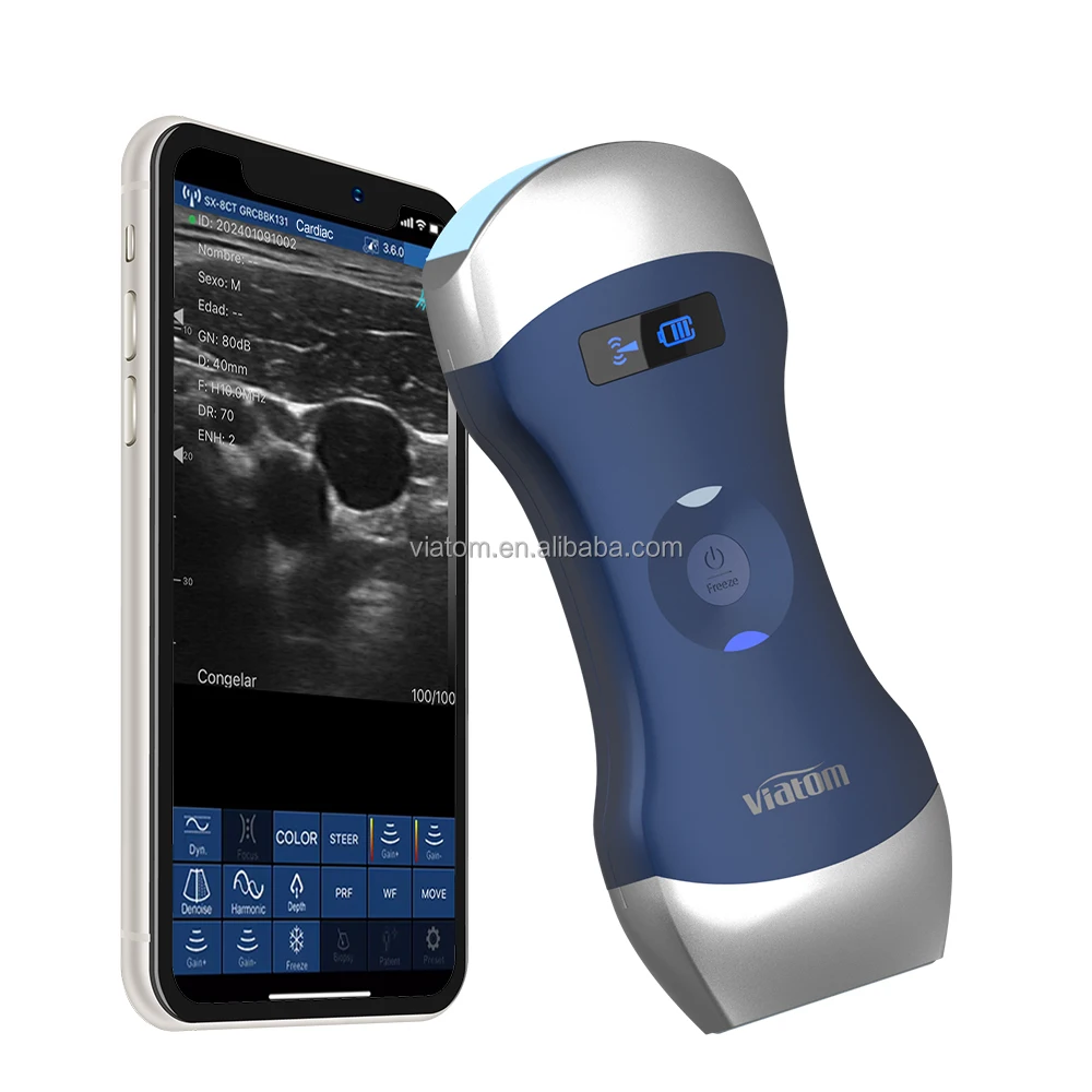 الموجات فوق الصوتية قبل الولادة يقيس الصحة الشاملة والنمو وتنمية الجنين