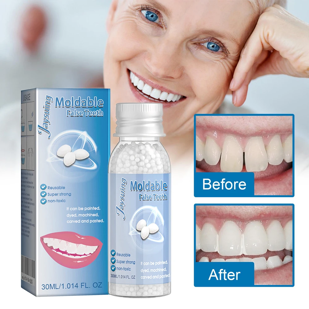 

30g Temporary Tooth Repair Moldable Teeth And Gaps False Tooth Solid Gel Adhesive Fake Teeth Beauty Tool Dental Supplies