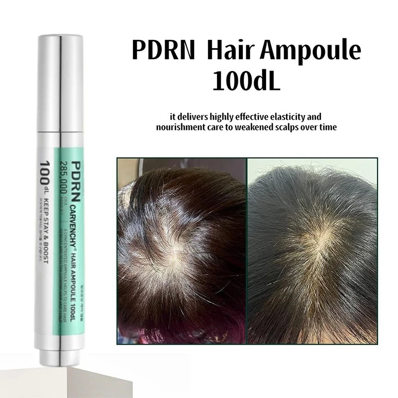 

Fast Ampoule Hair Growth Essence Anti Hair Loss Baldness Repair Damaged Scalp Treatment Nourish Hair Root Care Product Women Men