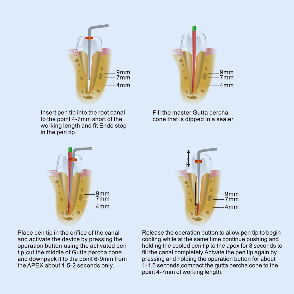 Azdent Dental Cordless Wireless Gutta Percha Obturation System Endo beheizter Stift + 2 Spitzen