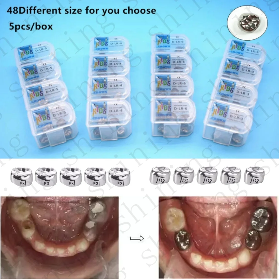 

Dental Crown Kids Primary Molar Refill Stainless Steel for Upper/Lower Left/Right 1st/2nd Crowns Molar Teeth Therapy Tool