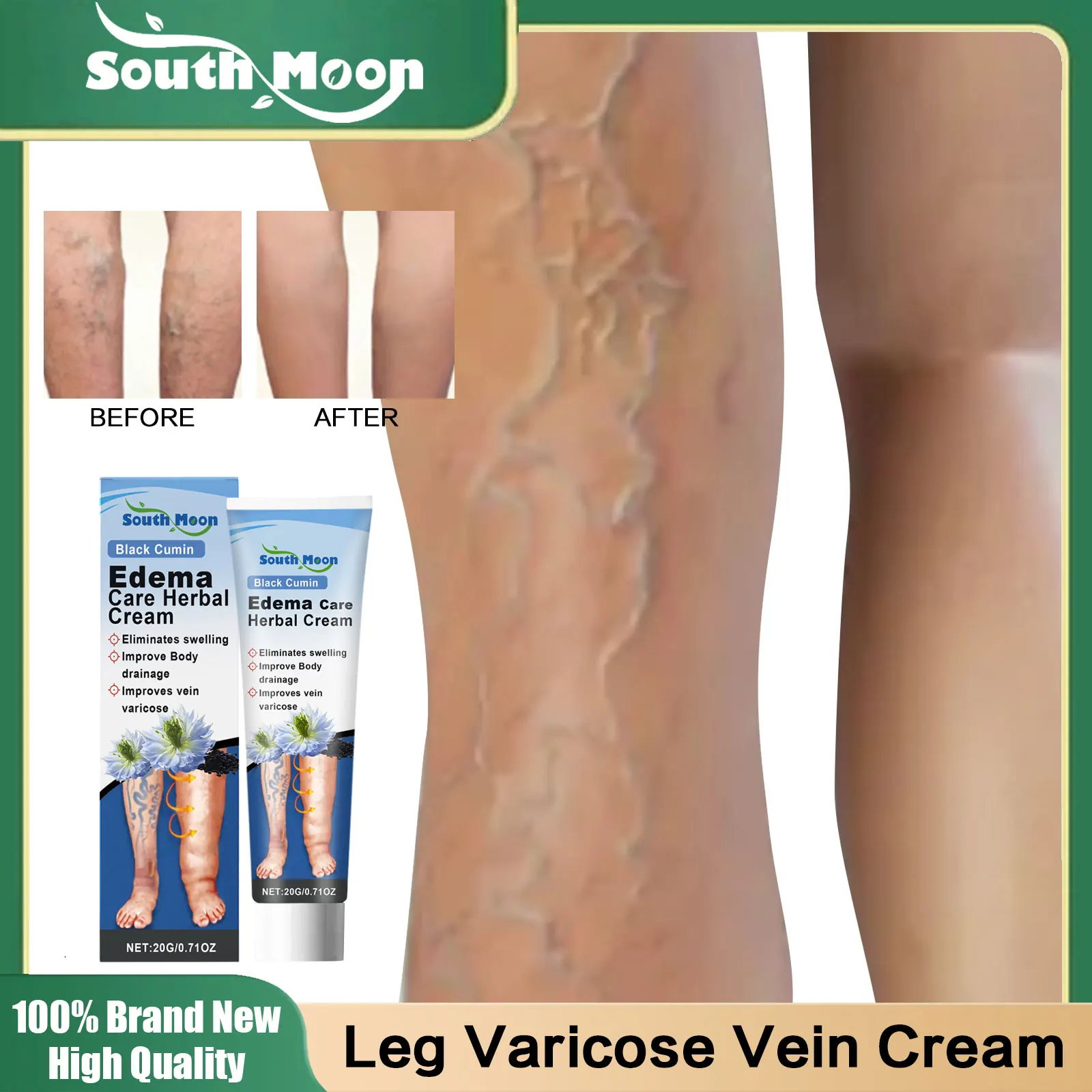 

Herbal Cream for Varicose Veins Remove Spider Veins Therapy Relieve Calf Muscle Aches Swelling Eliminate Edema Leg Care Ointment