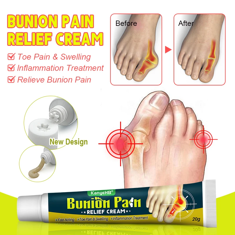 1Pcs Foot Gout Cream Arthritis Bone Thumb Corrector Finger Hallux Toe Bunion Joint Pain Relief Herbal Medical Care Ointment G049