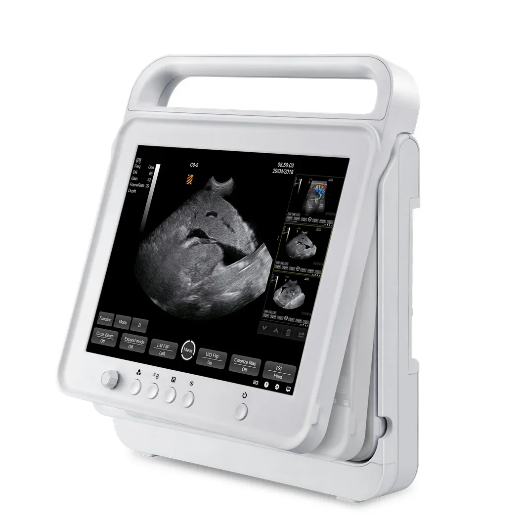 Medical Ultrasound Instruments Portable Touch Color Doppler Veterinary Ultrasonic Diagnostic System for Pregnancy