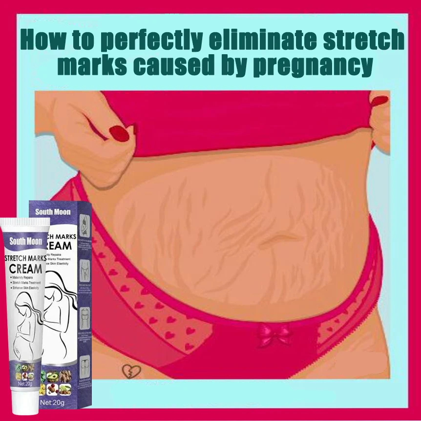 

HOT SALE Stretch Mark Cream Anti-wrinkle Anti-aging Maternal Skin Repair Remove Pregnancy Scar Treatment Body Skin Care
