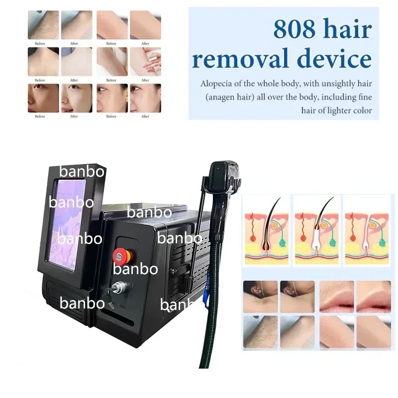 2024 Professional 808nm Diode Hair Removal Machine 808 755 1064 Permanent Hair Remover Equipment Painless Body Epilator Device