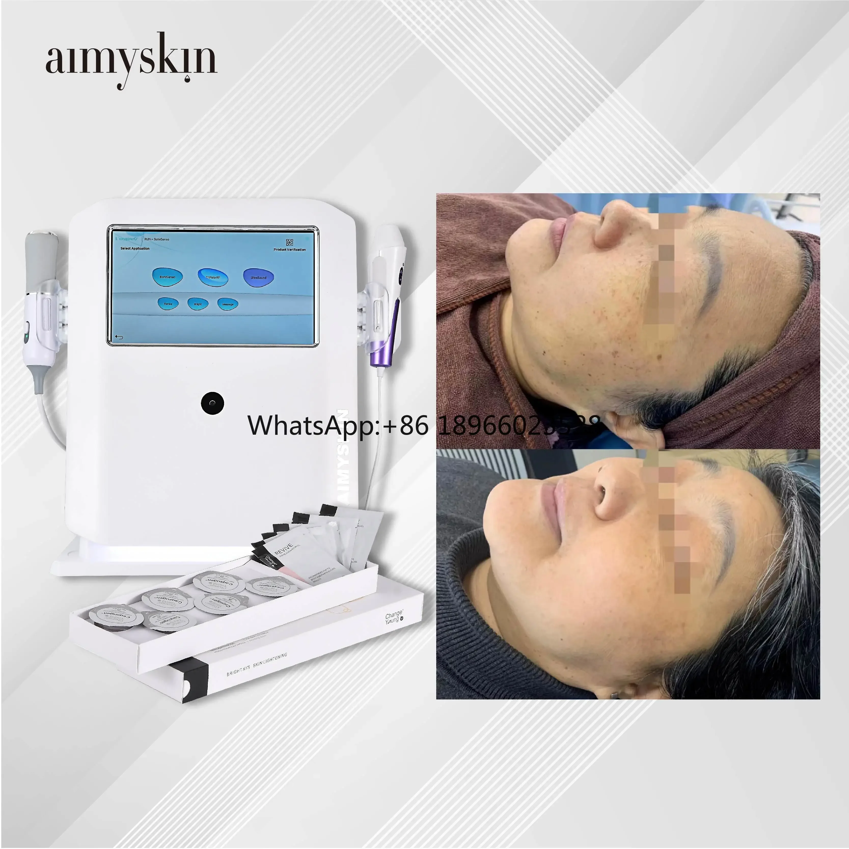 Analyzer AM-183   Tester AI Intelligent Digital Changeyoung Wood Lamp Scanner Facial Analyze Machine  Analyzer