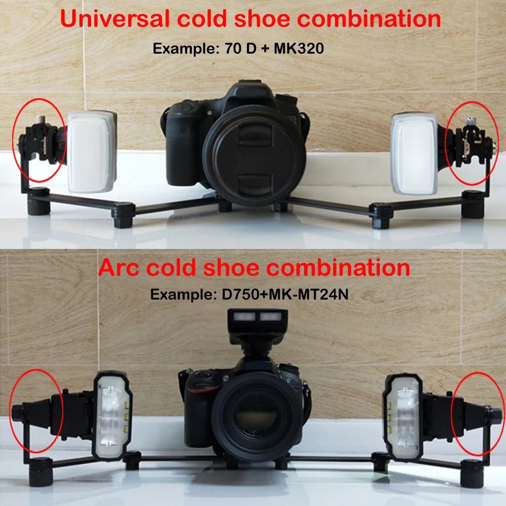 Oral Macro Photography Bracket Simulation Dual Head Flash Ring Flash Front Teeth Aesthetic Full Dentition Maxillofacial Photo