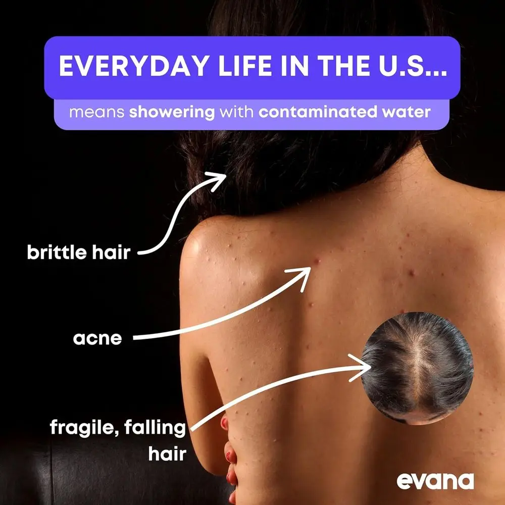 Filtr prysznicowy o wysokiej czystości - usuwa 99% chloru, metali ciężkich - akcesoria łazienkowe - głowice prysznicowe - wykończenie chromowane