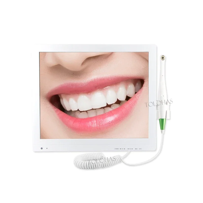 LHMDTM  oral  high-definition equipment real time intraoral   system