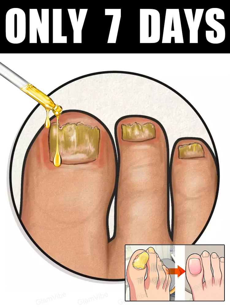 ستصبح منتجات العناية بالقدم مشاكل الأصابع وأصابع القدم الأكثر مبيعًا في عام 2025. #1