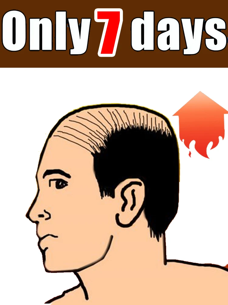 

Нет проблем, помогаем людям с проблемами волос, горячая распродажа, унисекс, 7 дней