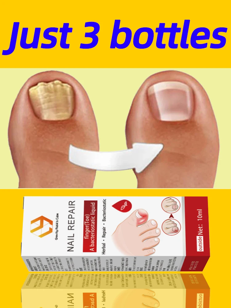 Solves foot Nails troubles