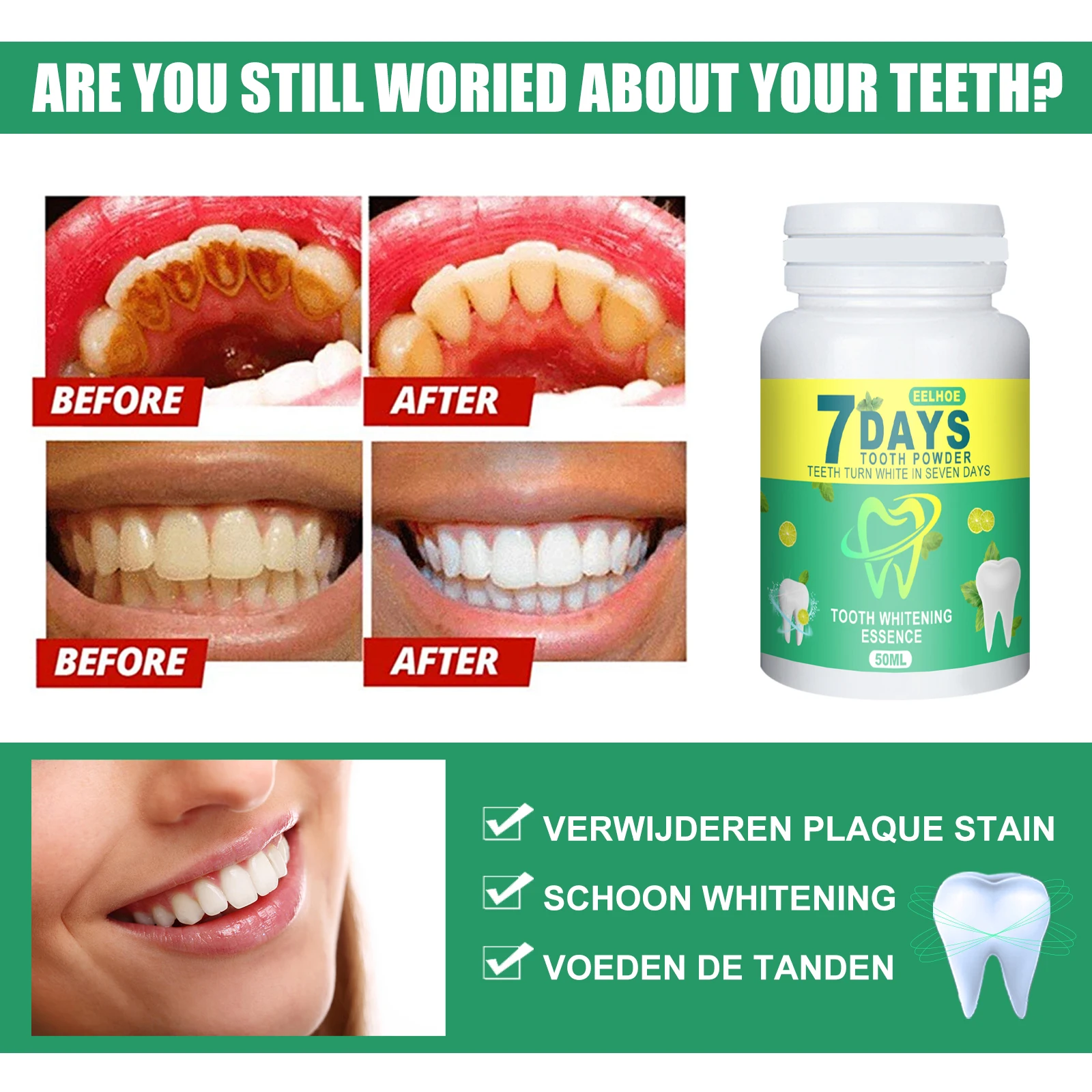 5 일 화이트닝 치아 파우더 노란색 얼룩 제거 치과 표 - Teeth Whitening Retainer 리뷰 및 가격