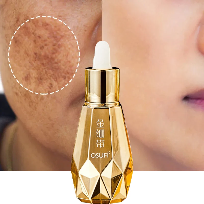 Facial Dark Spot Removal Serum Remove Melasma Age Spot Sun Spot Lightening Pigmentation Whitening Brightening Skin Care 60ml