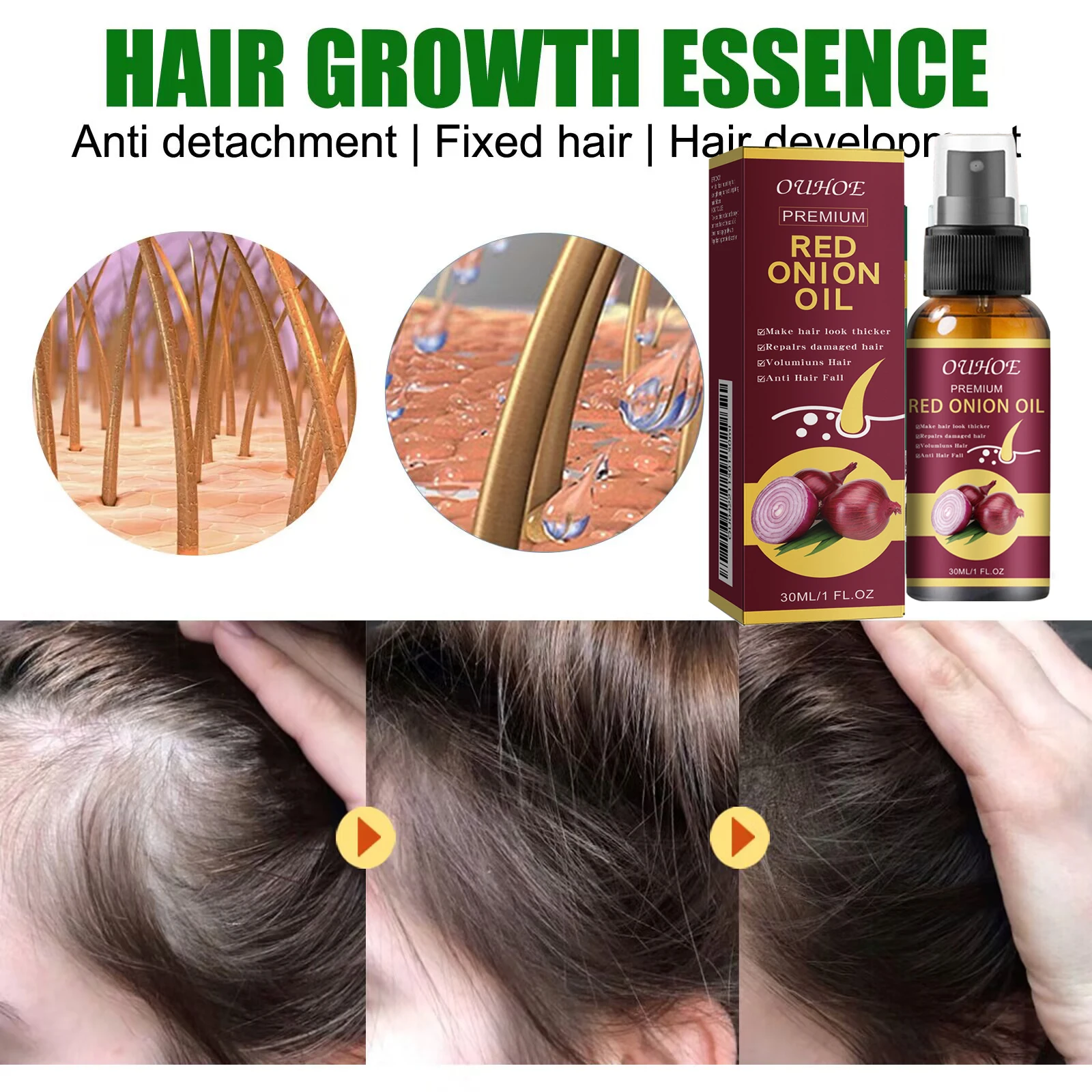 Powerful Hair Growth Serum Spray Anti Hairs Loss Treatment Essence Repair Nourish Roots Regrowth Hair Beauty Care For Men Women