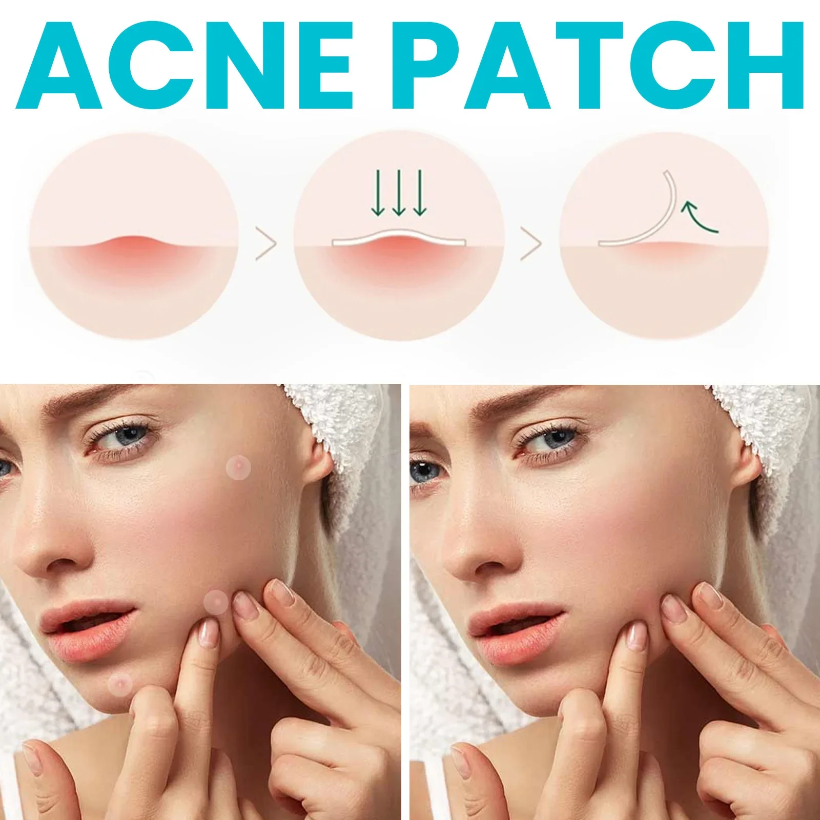 Parche de granos de acné impermeable, curativo, absorbente de imperfecciones, cubierta de máscara Facial, reparación de manchas, corrector de Control de aceite suave, cuidado de la piel