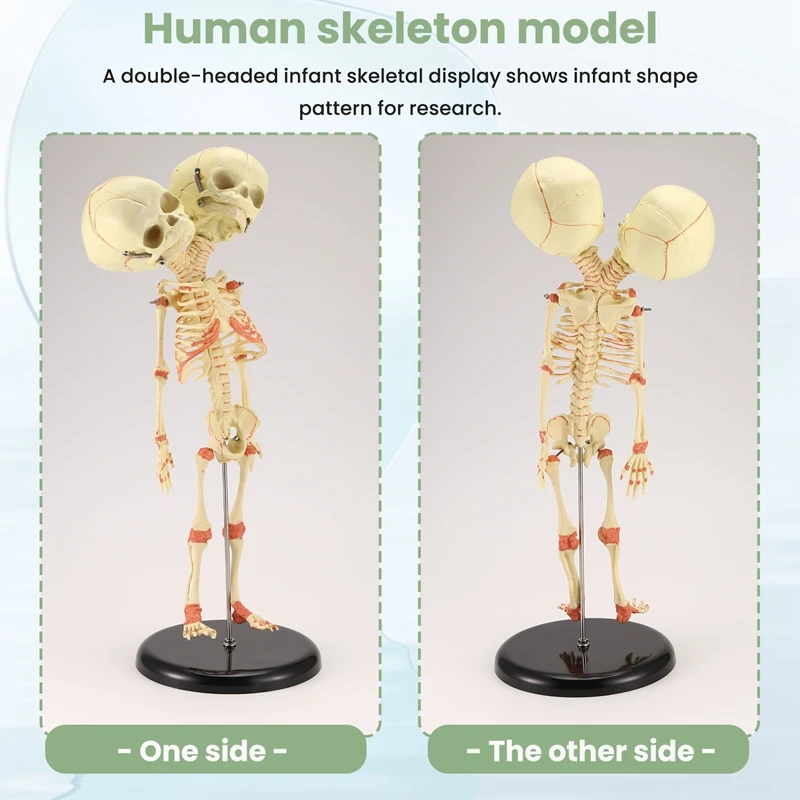 A35Q-Human Body Double Heads Baby Skull Bone Anatomy Brain For Display Research Teaching