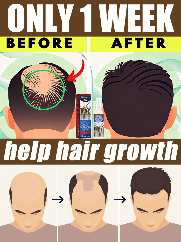 

Gɪɴɢᴇʀ Sᴘʀᴀʏ Aɴᴛɪ Nᴏᴜʀɪsʜ Sᴄᴀʟᴘ Sᴛʀᴇɴɢᴛʜᴇɴ Rᴏᴏᴛs Fᴀsᴛ Tʜɪᴄᴋ Hᴀɪʀ Cᴀʀᴇ