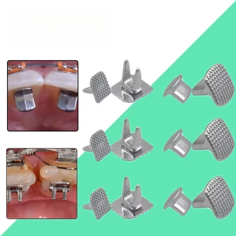 10pcs Orthodontic Tongue Corrector Orthodontic Tongue Tail Single Block Bite Device Single Wing Generator Adhesive Hinge Nail