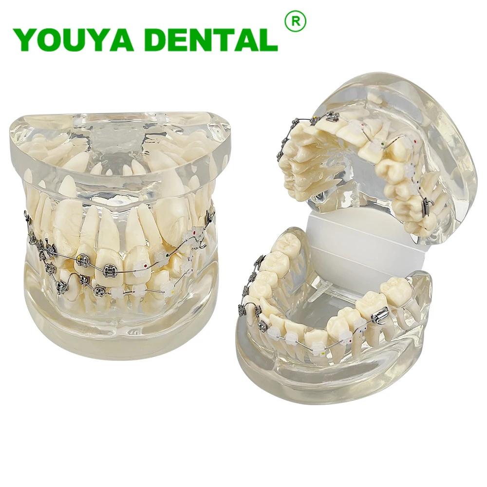 Dental Orthodontic Model Resin Teeth Model Ortho Treatment Model For Patient Communication Dentist Student Teaching Study Models