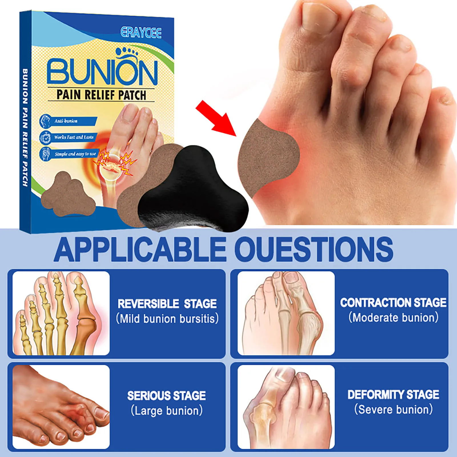 8pcs Anti Bunion Patches Bunion Corrector Toe Separator Orthopedic Straightener Foot Bunion Pain Swelling Relief Patch Foot Care