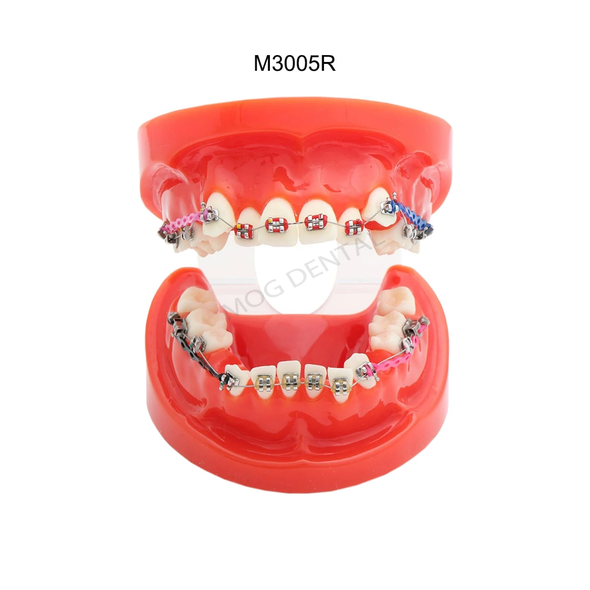 Dental Model with Orthodontic Bracket Dental Teaching Model For Dentist Treatment Demo Training Studying