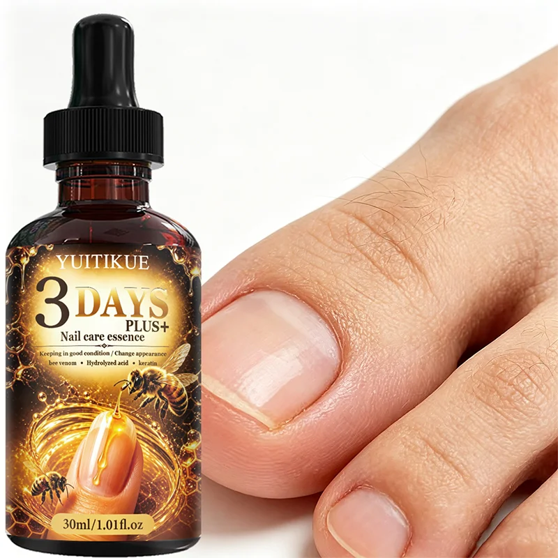 YUITIKUE 3 Days Bee Venom Nail Essence 30ml Keratin Strengthen Brittle Nails Repair Damaged Fingernail Toenail Care