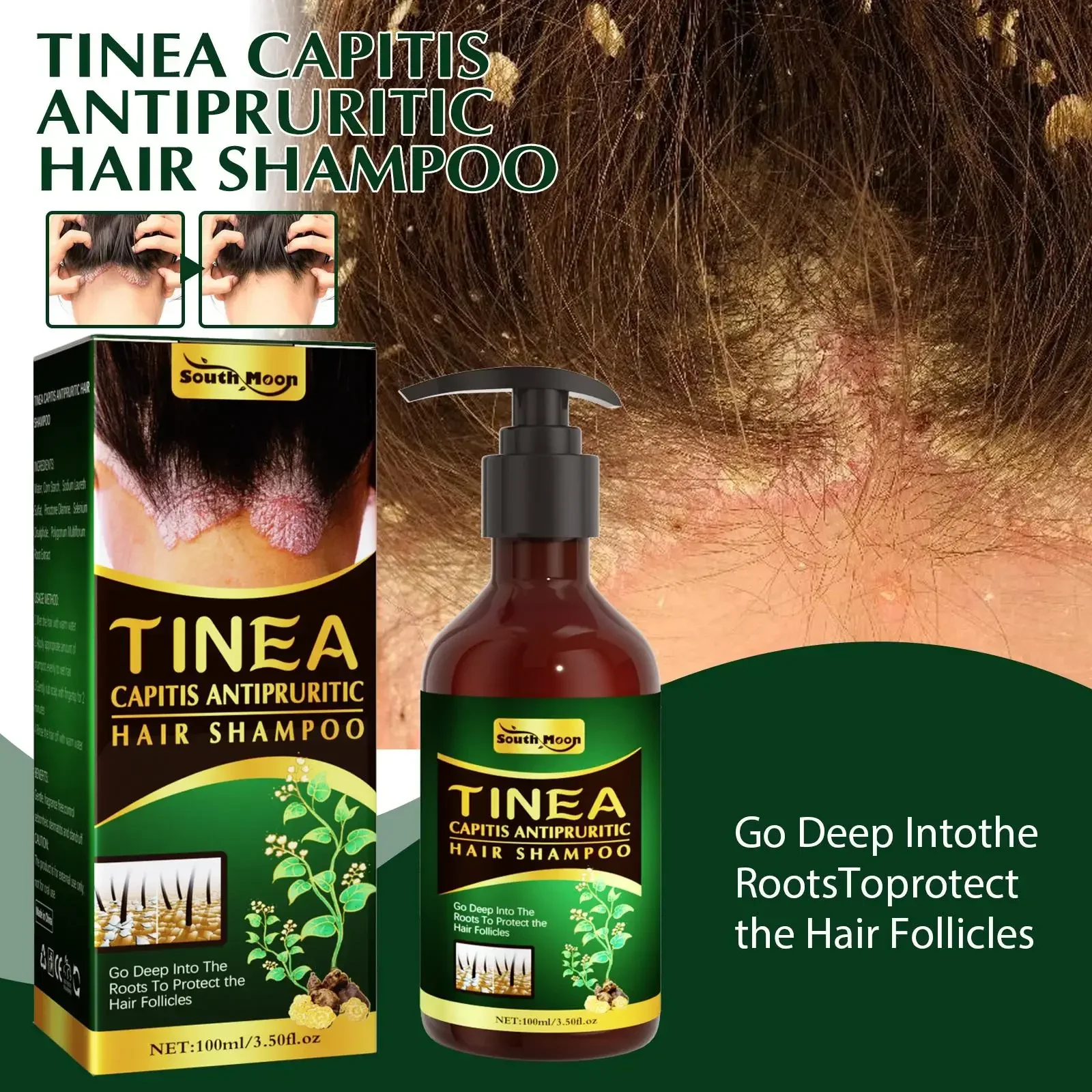 

Therapeutic Shampoo Anti-dandruff Treatment Itching Seborrheic Scalp Herbal Shampoo Skin Care for Hair 100ml Шампунь Для Волос
