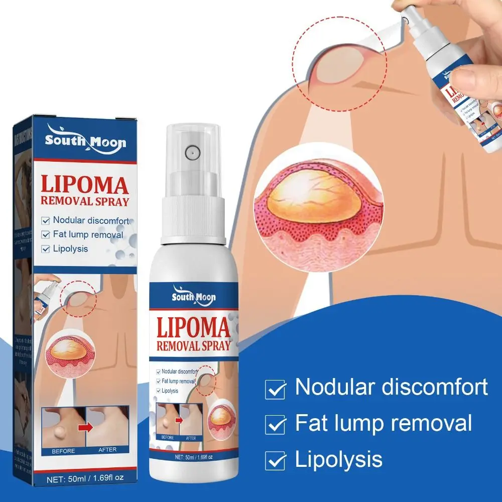 50ml New Relieve Treatment Instant LumpFree Lipoma Lipoma Removal Spray Lipomheilung Reduction Spray