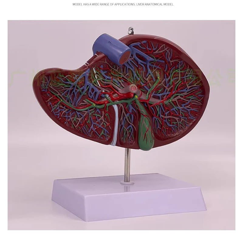 Highly simulated liver model, liver anatomical model, hepatobiliary, pancreatic, splenic and duodenal relief lesion, hepatobilia