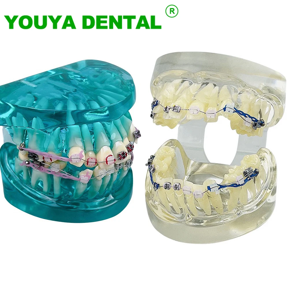 Orthodontic Treatment Model Dental Typodont Teeth Demonstration Model With Braces Brackets Chain Ties Arch Wire Dentistry Model