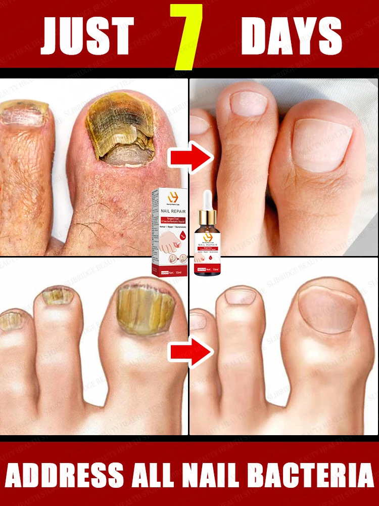 

Nail problems Solved in 7 days!