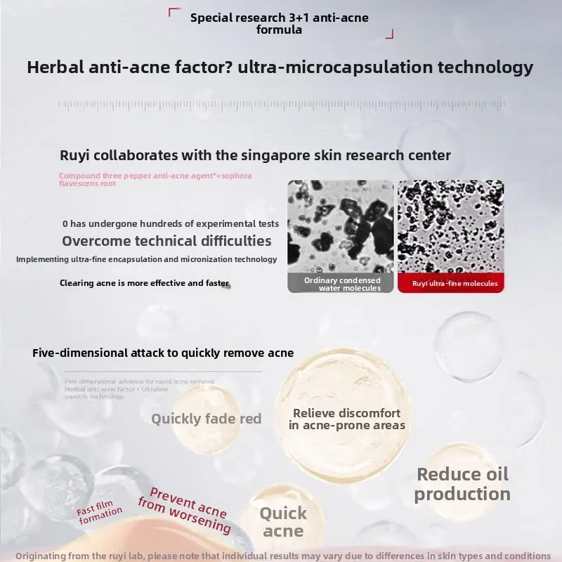 RUYI كريم وجه ترطيب إصلاح تفتيح علامات حب الشباب الحفر ترطيب الجمال الصحة تقليص المسام العناية بالبشرة كريم وجه