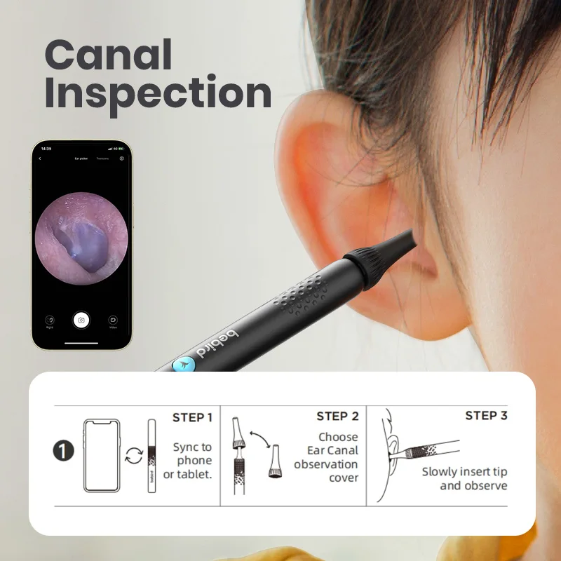 2024 New Arrival-Bebird ENT Observation Kit Set (Not Include Camera Device）For Visual Ear Canal / Nasal / Oral Inspection