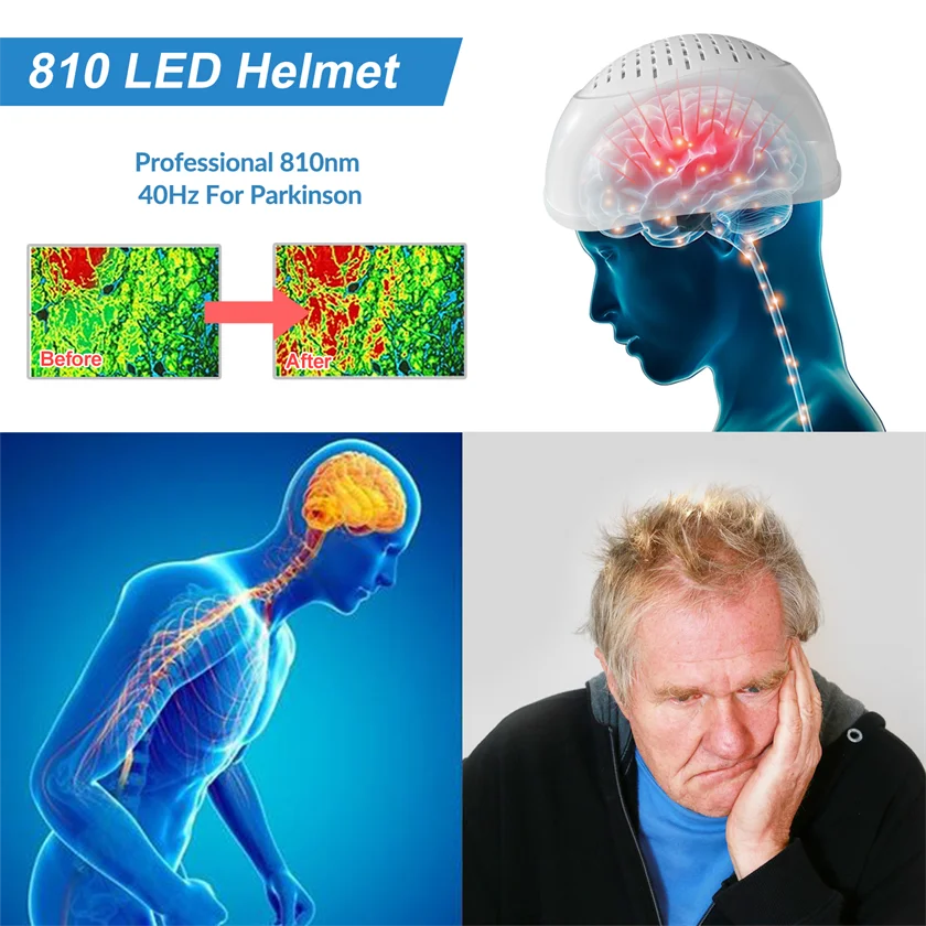 Dawfek fotobiomodulación LED casco cerebral 810nm máquina de terapia de luz roja para tratamiento de autismo de accidentes cerebrales de depresión Parkinson