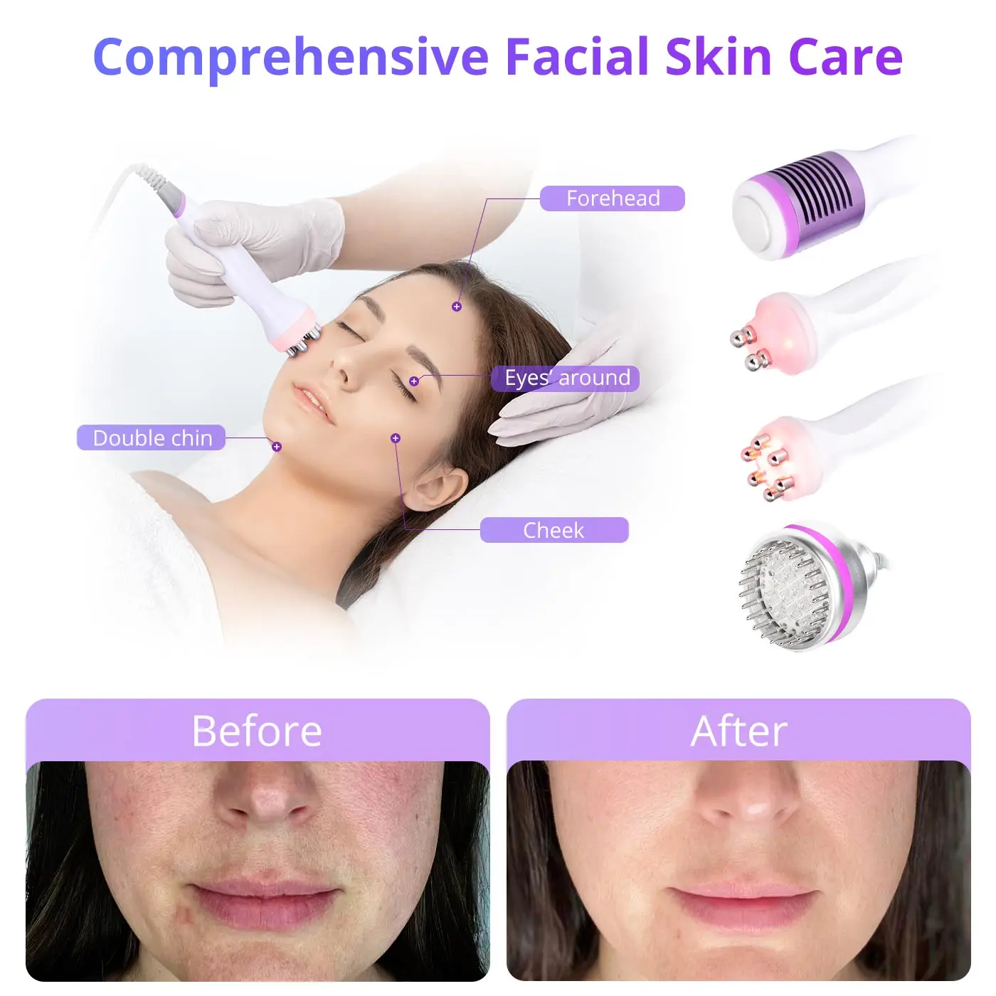 Thumbnail 2 - #75 Best Body Shaping Massage Equipment to Buy In 2026