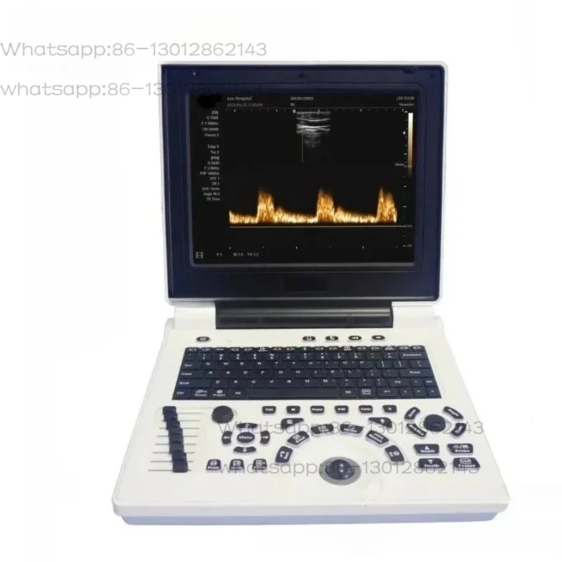 Direct Factory Ultrasound Scanner Veterinary Machine Laptop 12 Inch Portable Black and White Belt Microconvex Probe