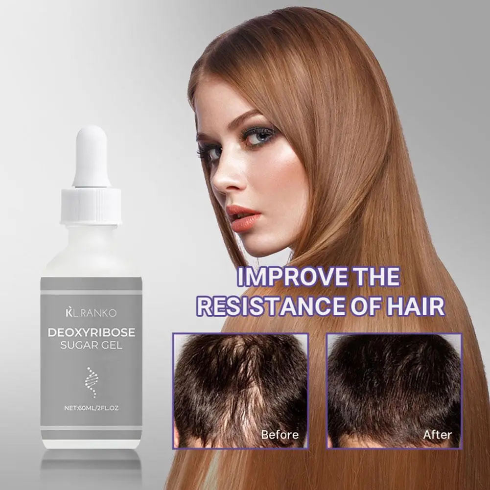 

Ginger Hair Care Essential Oil Nourish Scalp Hair Follicles Control Oil Strengthen Gentle Hair Solution Refresh Nutrient Ro E4H9