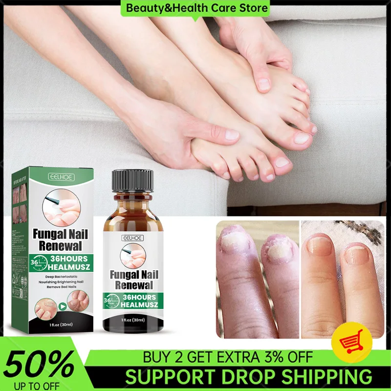 30ml Fungal Nail Renewal Deep Bacteriostatic Nourishing Brightening Nail Remove Bad Nails Daily Care Herbal Exfoliation Solution