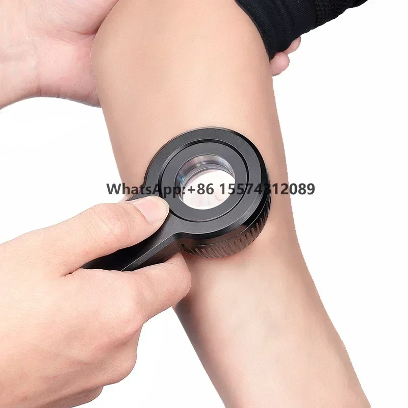 Medical Dermatoscope for Dermatology, USB rechargeable LED Lesion Research digital dermatoscope