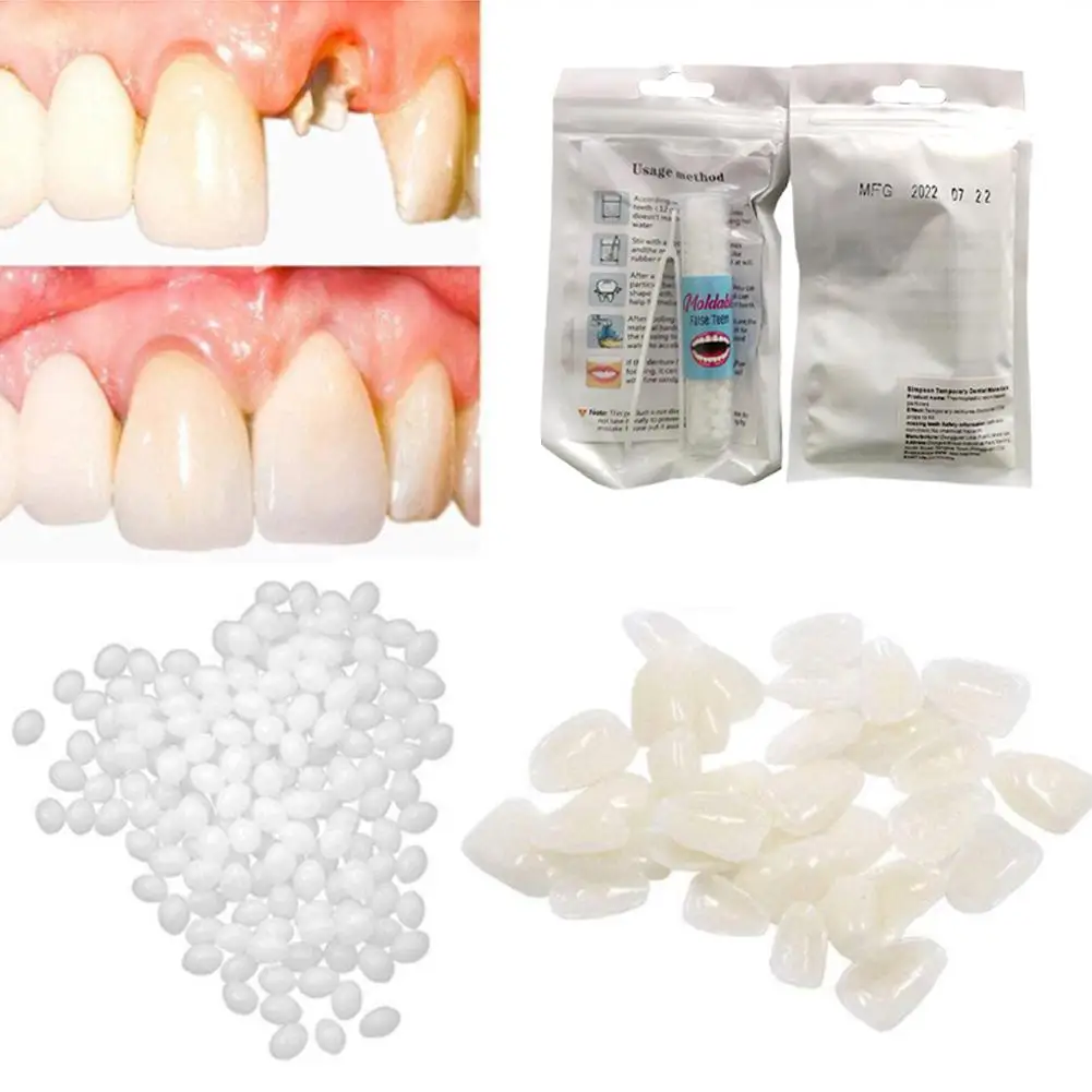 Kit de reparación temporal de dientes, pegamento para blanqueamiento dental, adhesivo para dentaduras postizas, huecos para dientes sólidos, W7V5, 5g/10g/15g/20g