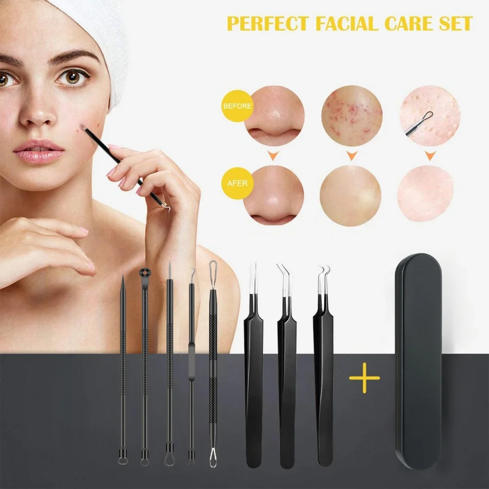 여드름 바늘 및 블랙헤드 핀셋 세트 - 전문적인 얼굴 피부 미용 관리를 위한 모공 클렌징 도구