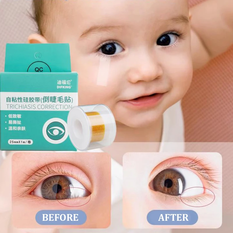 1 Roll Eyelid Droop Corrective Patch Inverted Eyelash Tape Easy Operation Multipurpose Good Breathability Transparent For Home