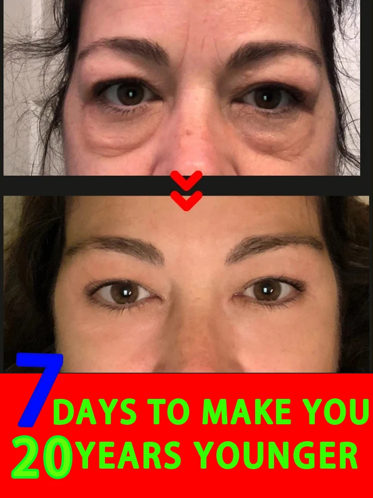 The most effective eye cream in 2025, removes eye bags, dark circles, and crow's feet in 7 days. Pure natural plant essence extr