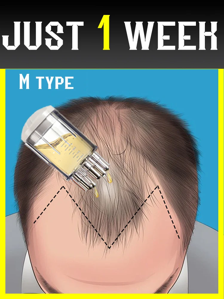 aplicador-rapido-peine-guiado-liquido-herramienta-para-masaje-del-cabello-del-cuero-cabelludo-con-esencia-para-el-crecimiento-del-cabello